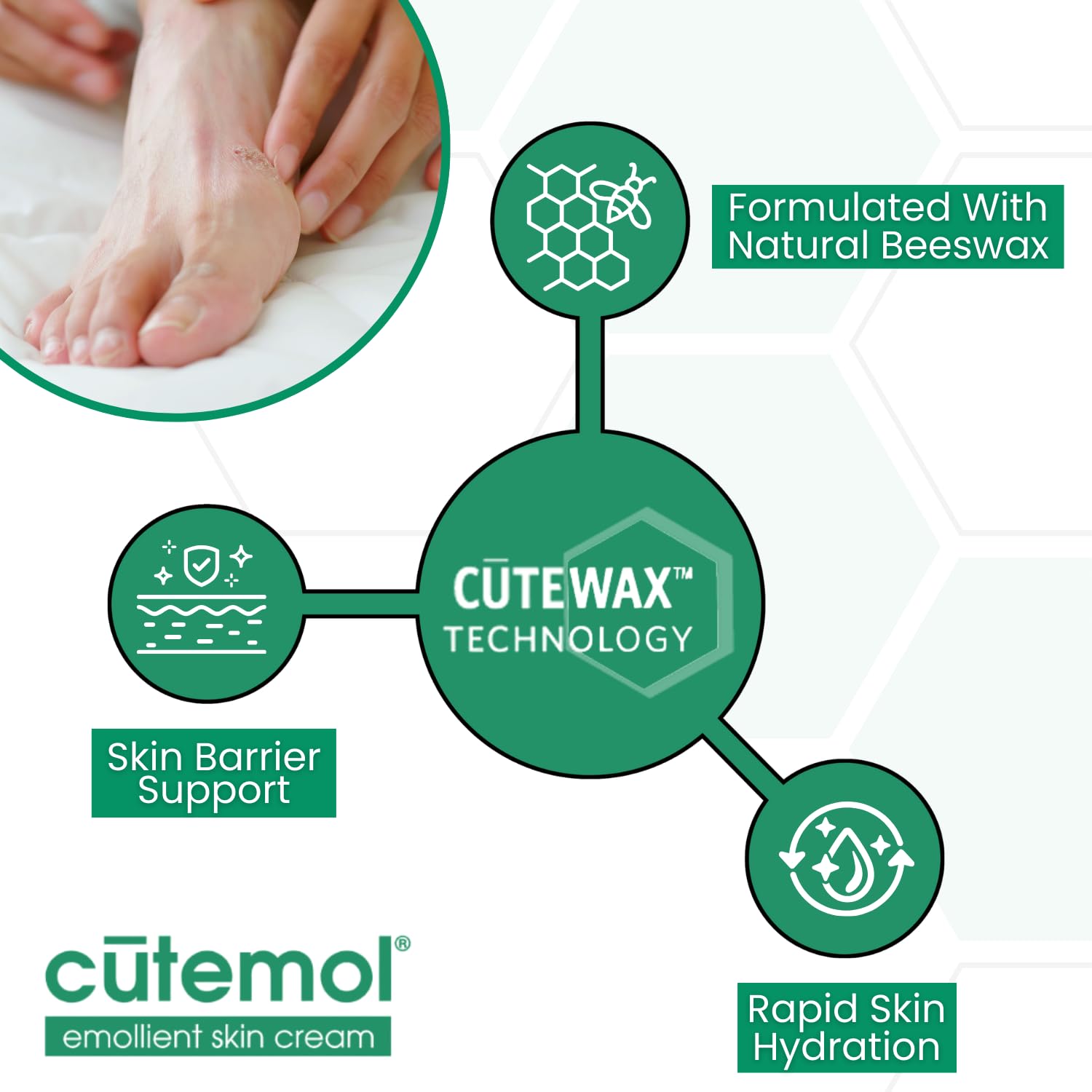 Cutemol Emollient Cream foot care shows targeted relief for dry, cracked feet.