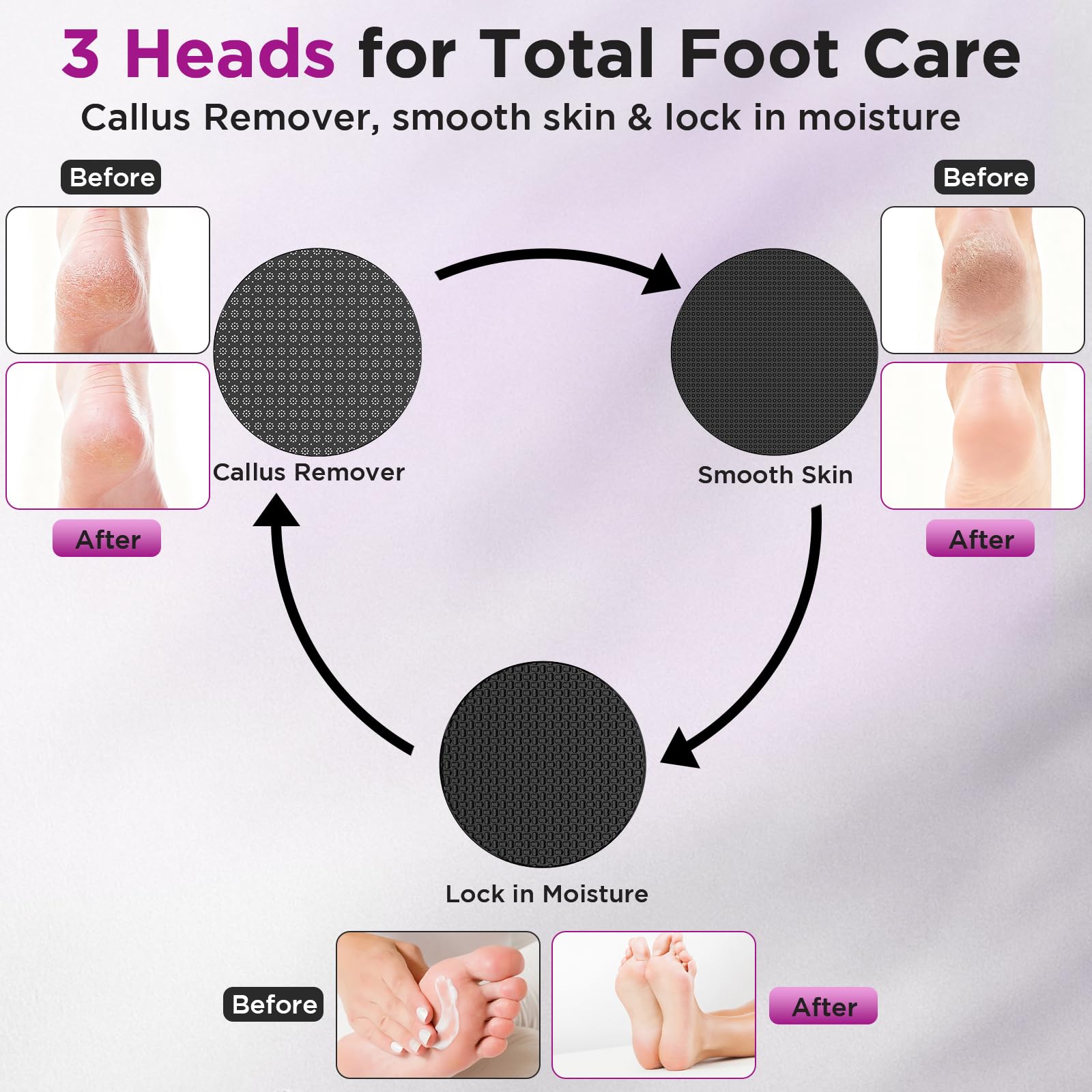 CYFERUY coarse and fine heads enable targeted callus care.