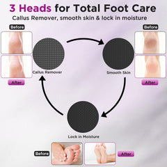CYFERUY coarse and fine heads enable targeted callus care.