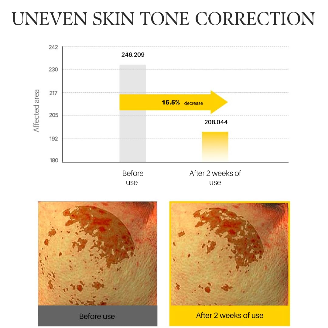 d'alba Piedmont skin texture improvement imagery suggests smoother skin.