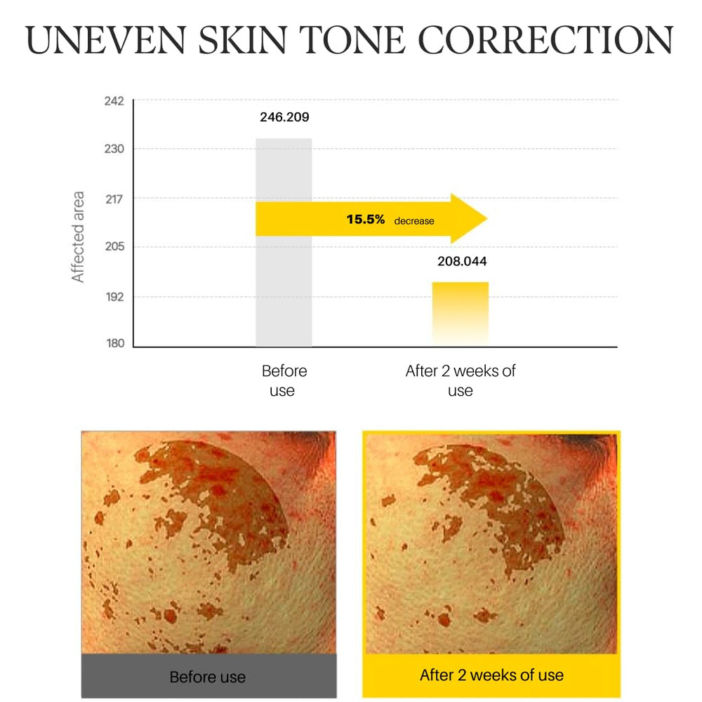d'alba Piedmont skin texture improvement imagery suggests smoother skin.