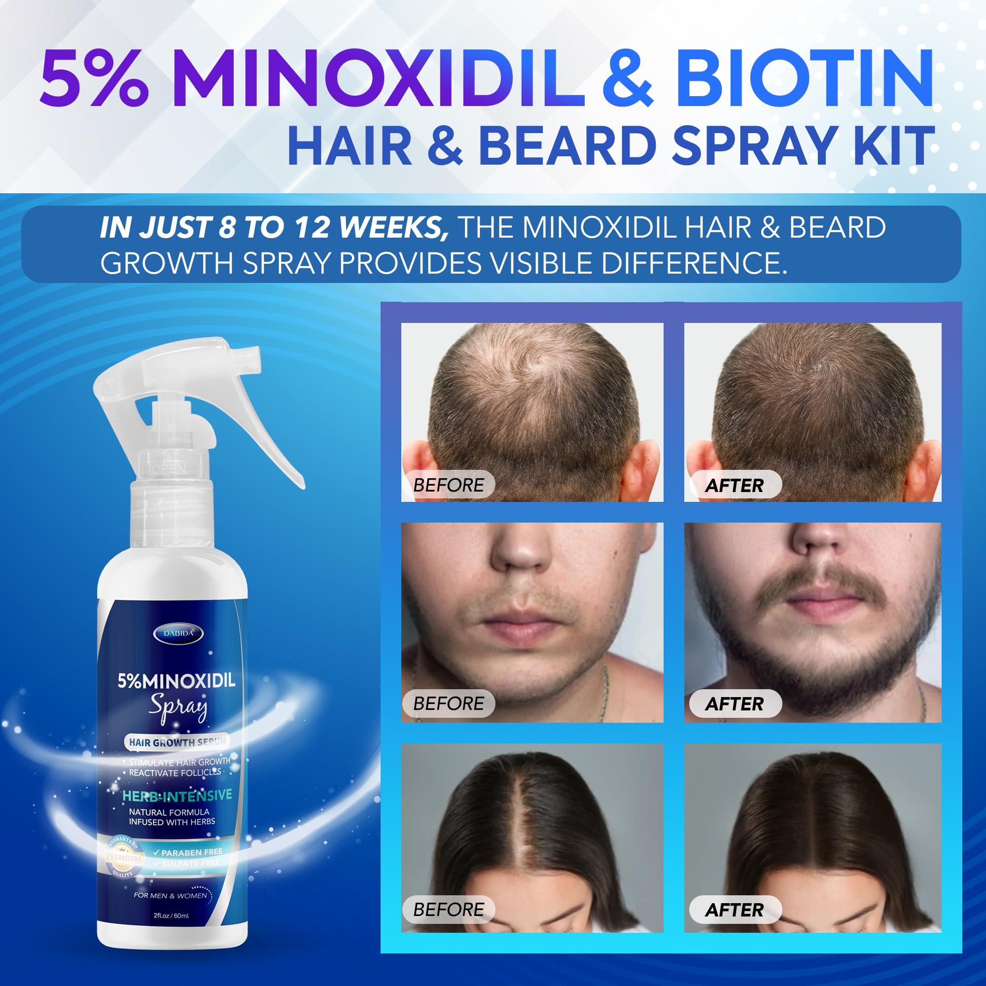 DABIDA Minoxidil spray aplicación diaria para estimular crecimiento capilar