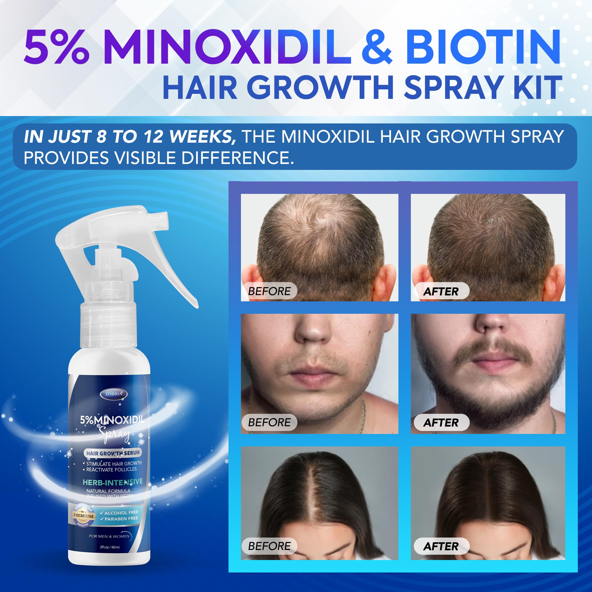 DABIDA Minoxidil spray dispensing for even coverage on thinning areas