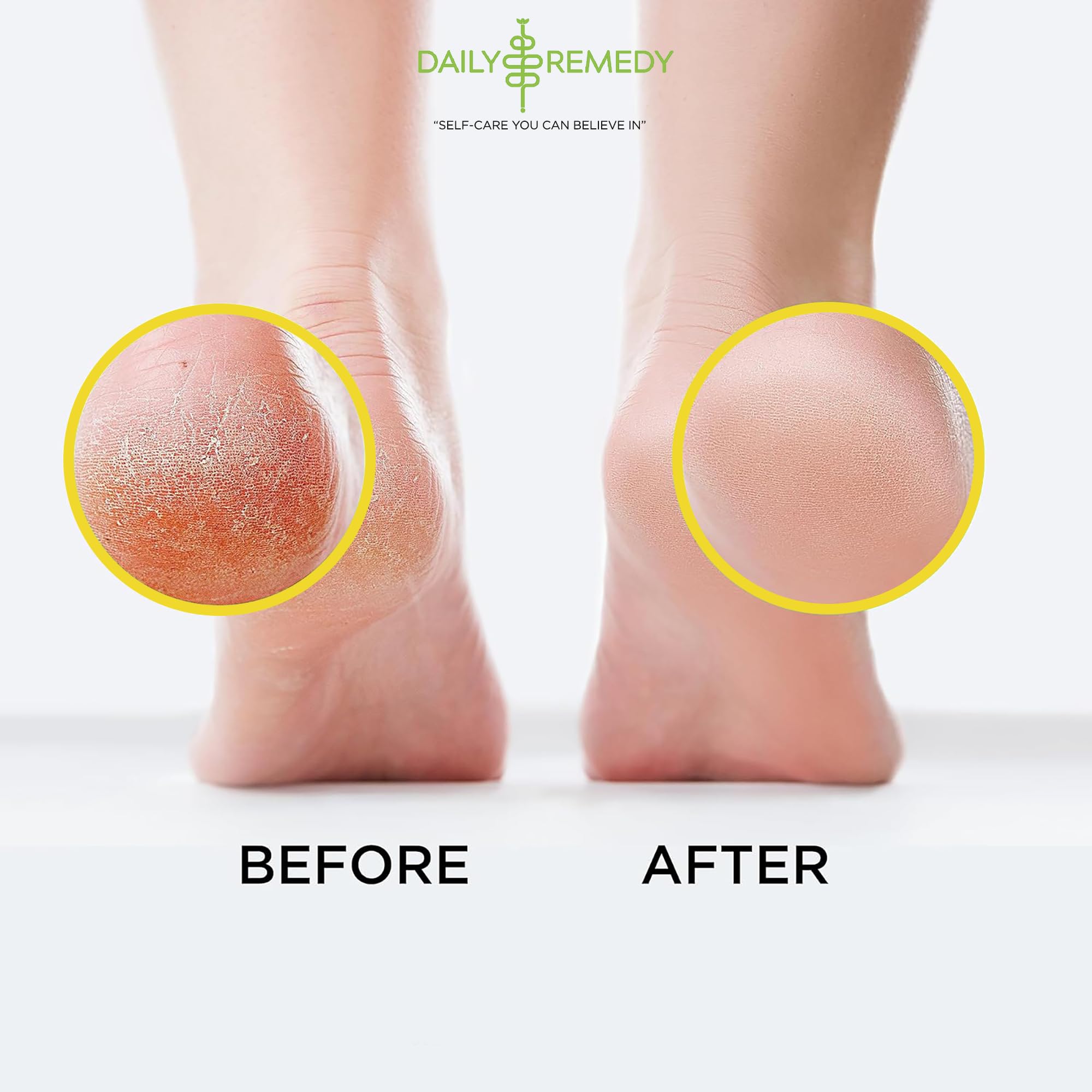 Daily Remedy: aromaterapia con aceites esenciales para bienestar de pies.