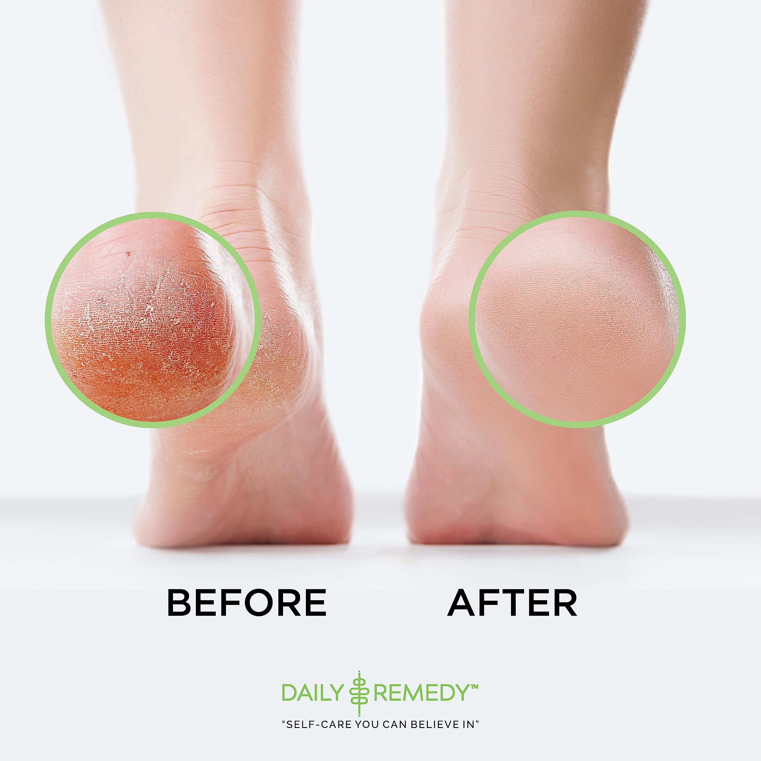 Daily Remedy: aroma fresco de aceites esenciales para pies
