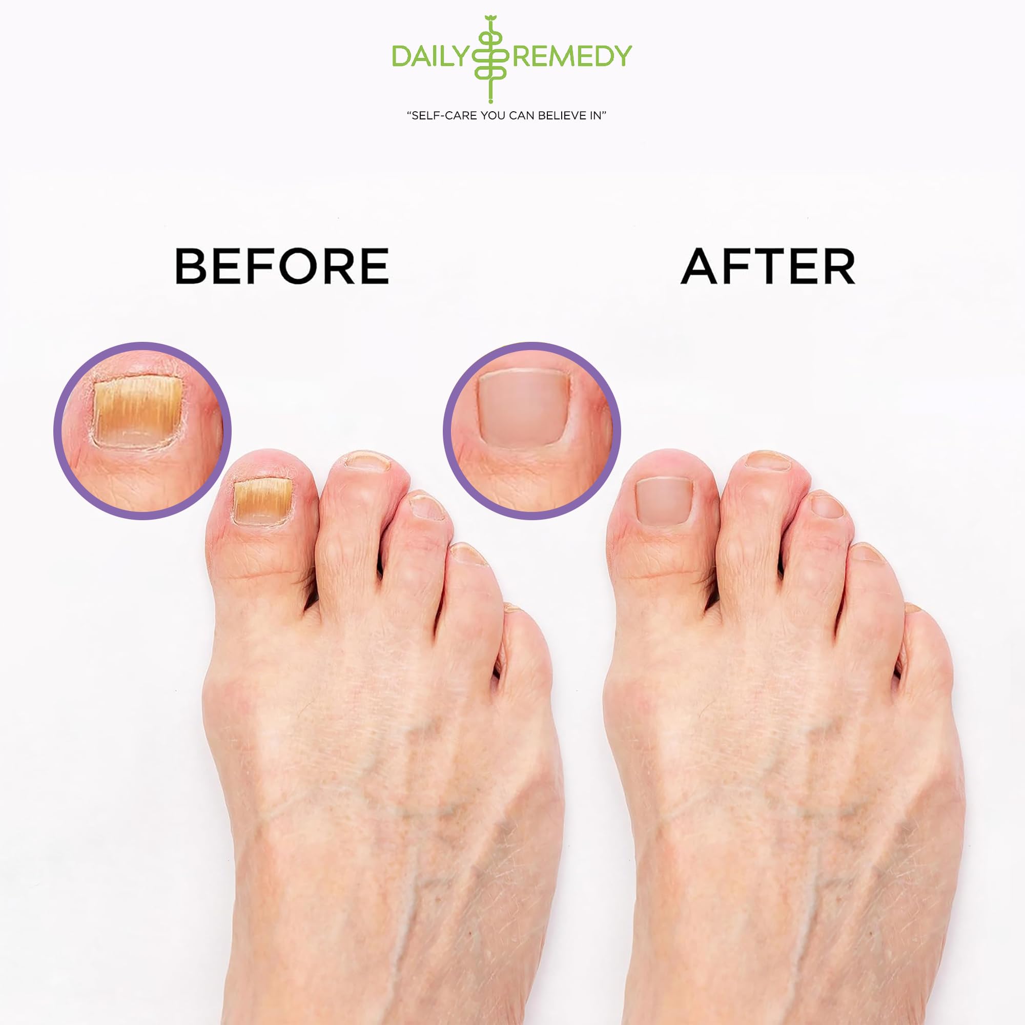 Daily Remedy Calming Lavender Foot Soak callos suavizados, piel de los pies suave