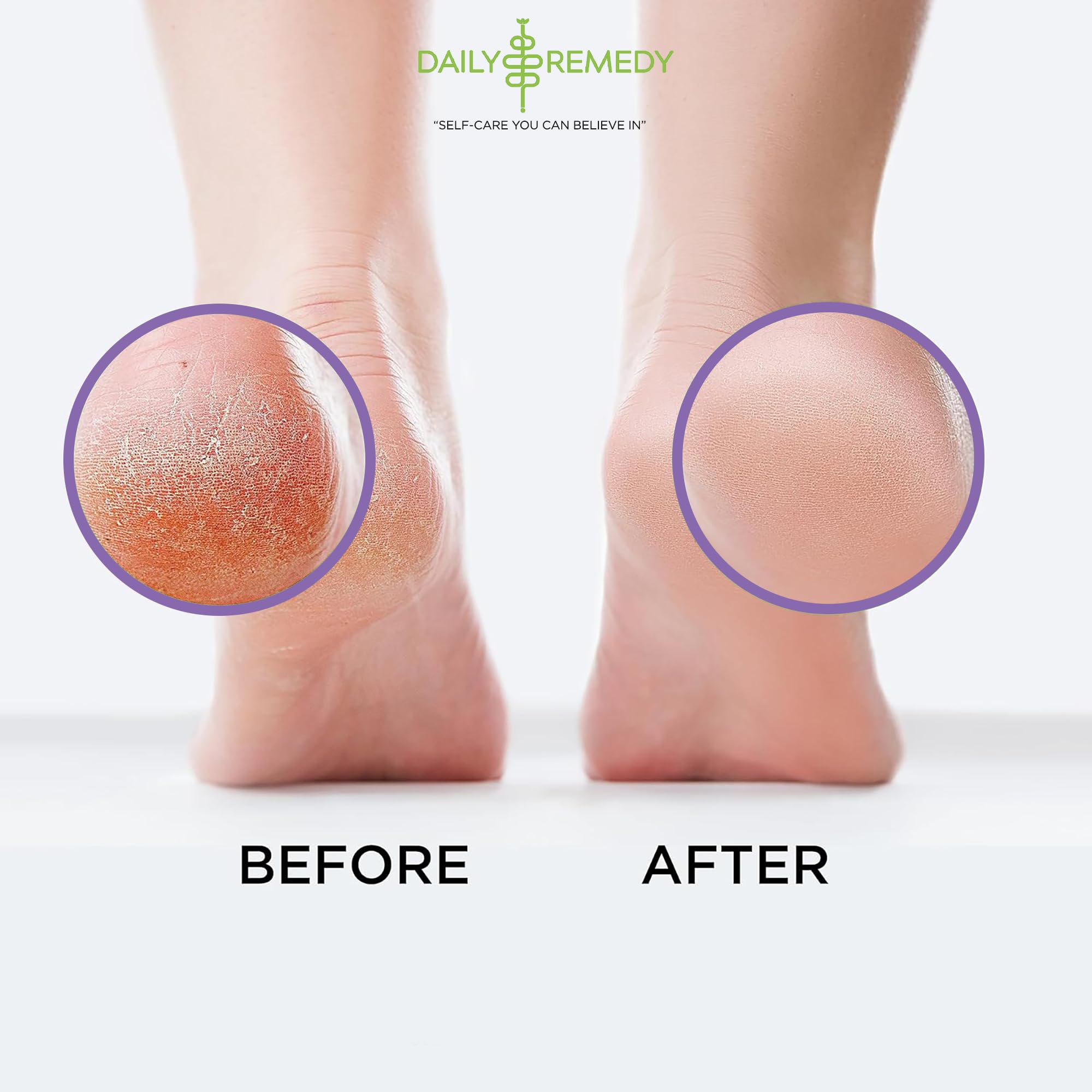 Daily Remedy Calming Lavender Foot Soak sal epsom, exfoliación suave de pies