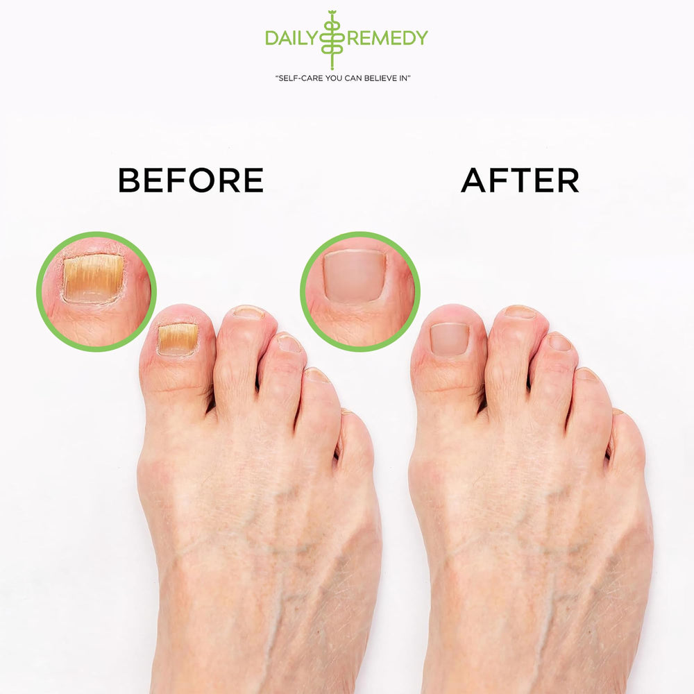 Daily Remedy Foot odor control soak for fresh feet.