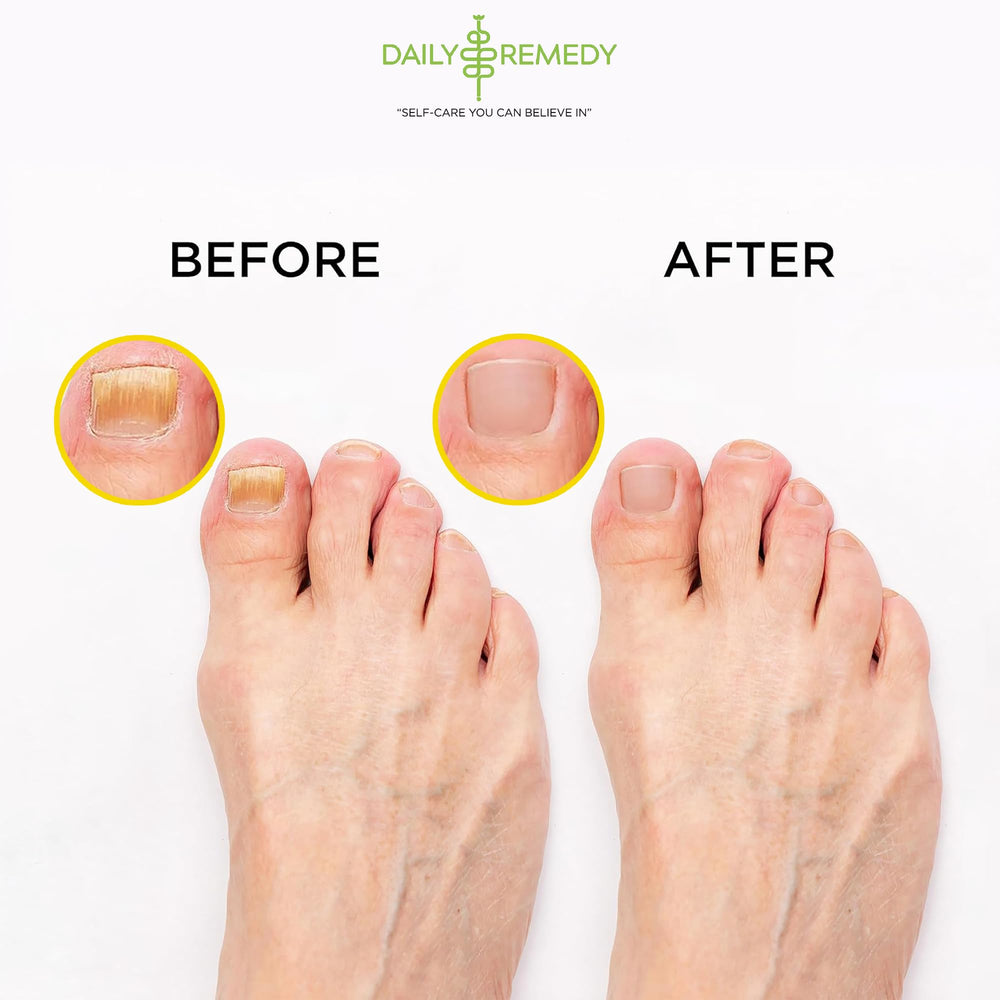 Daily Remedy: mezcla de ingredientes naturales para cuidado de pies.