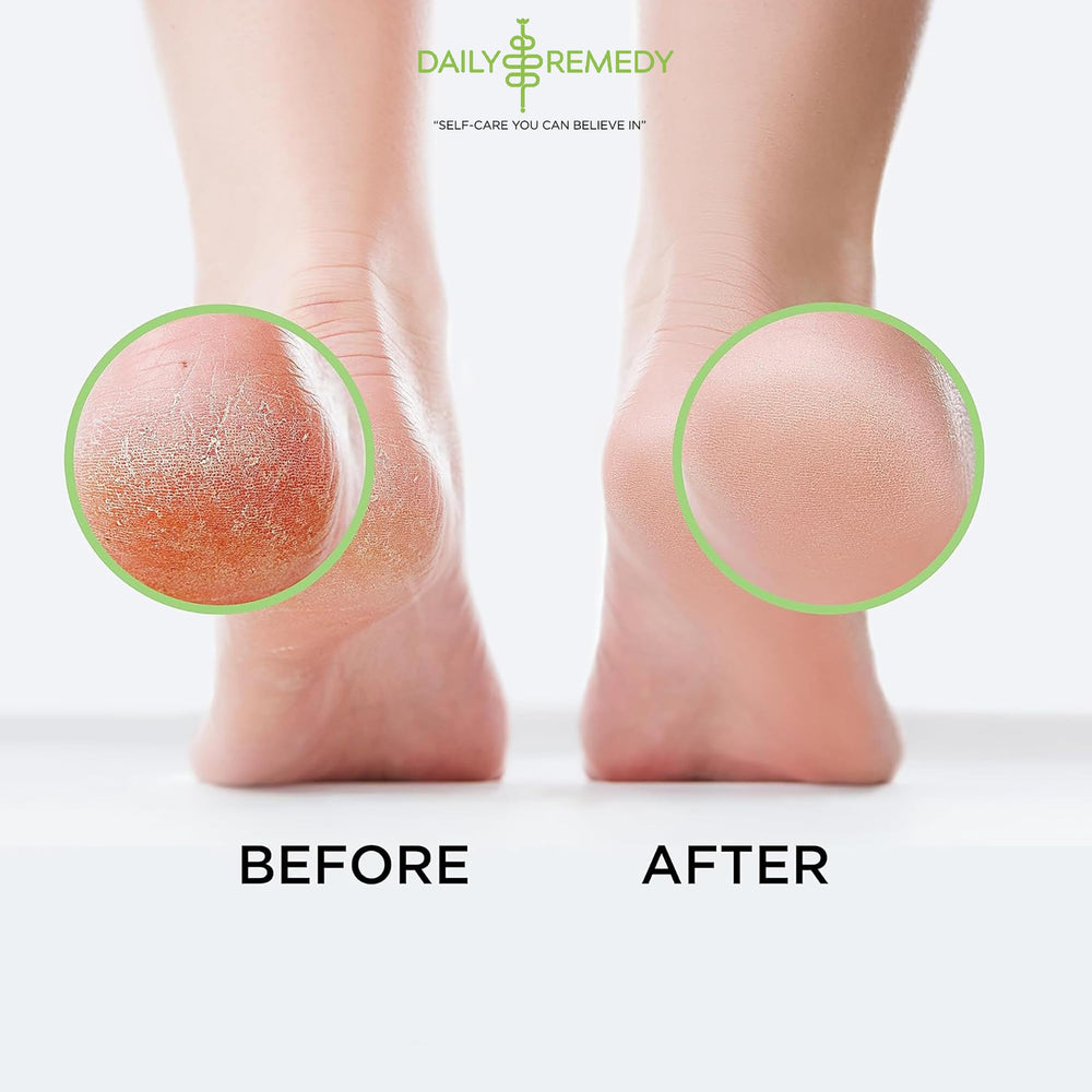 Daily Remedy olor-pies fresco ayuda a neutralizar olores