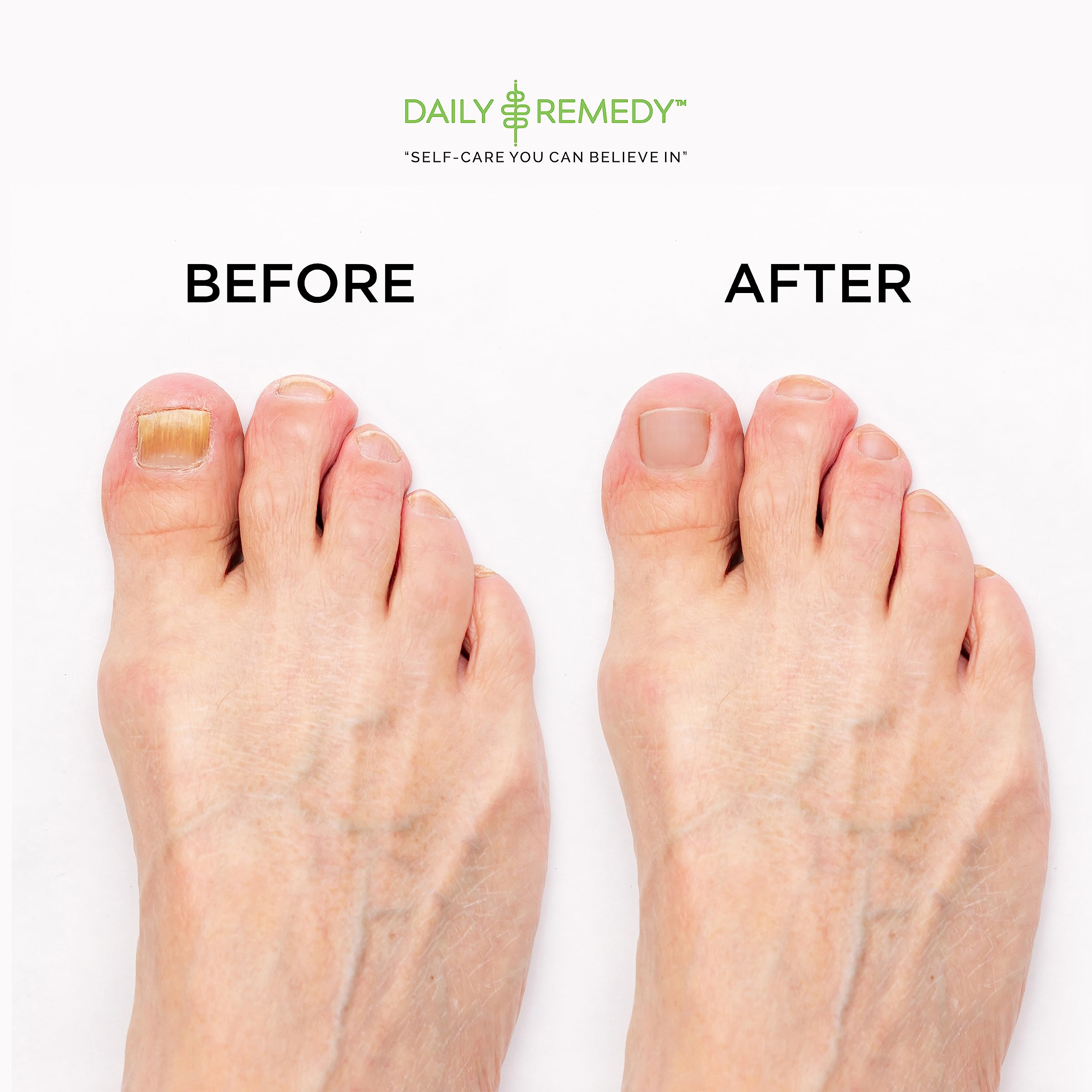 Daily Remedy: relajación en casa durante el ritual de pedicura