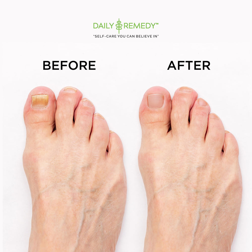 Daily Remedy: relajación en casa durante el ritual de pedicura