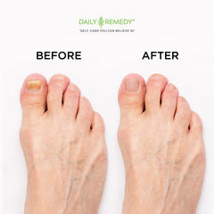 Daily Remedy: relajación en casa durante el ritual de pedicura