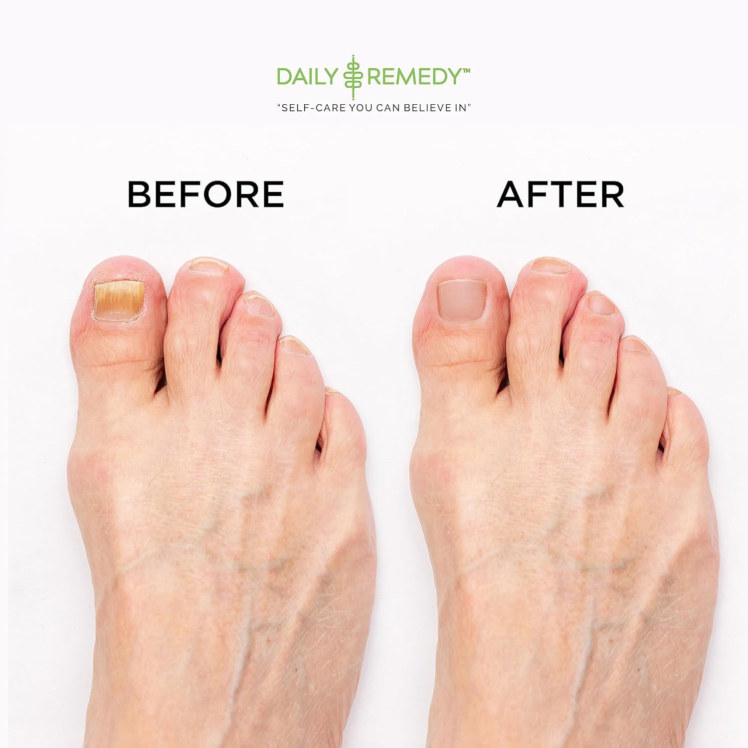 Daily Remedy Tea Tree Foot Soak with peppermint and lavender oils close-up