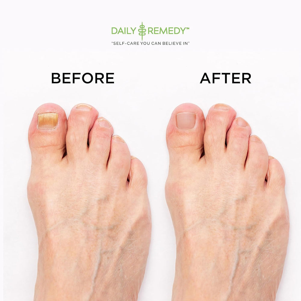 Daily Remedy Tea Tree Foot Soak with peppermint and lavender oils close-up