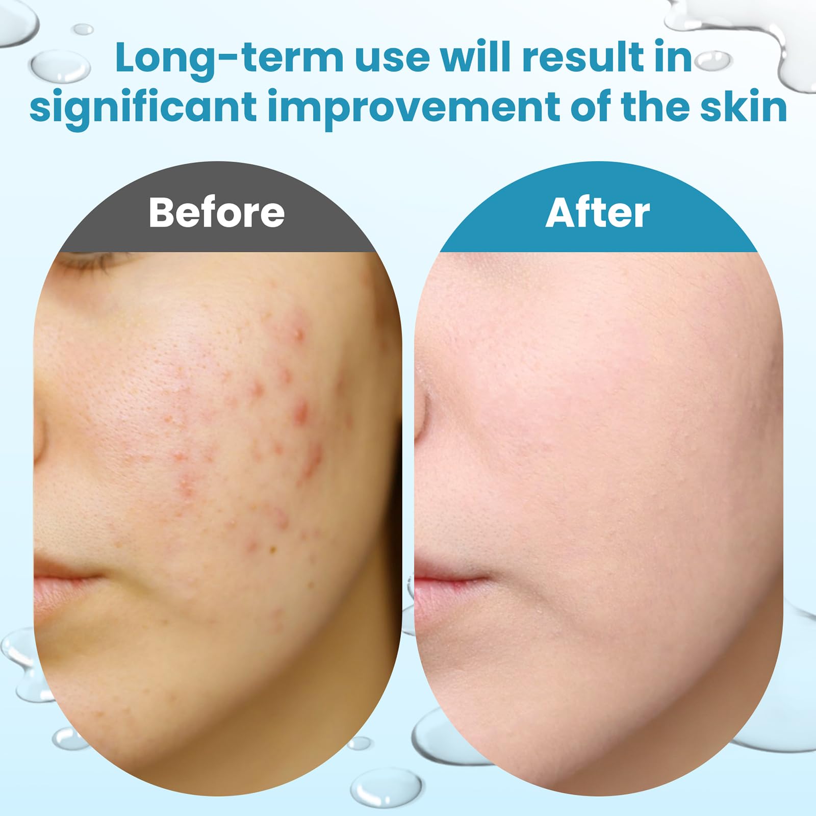 Dalin: persona aplicando disco exfoliante suave en la cara.