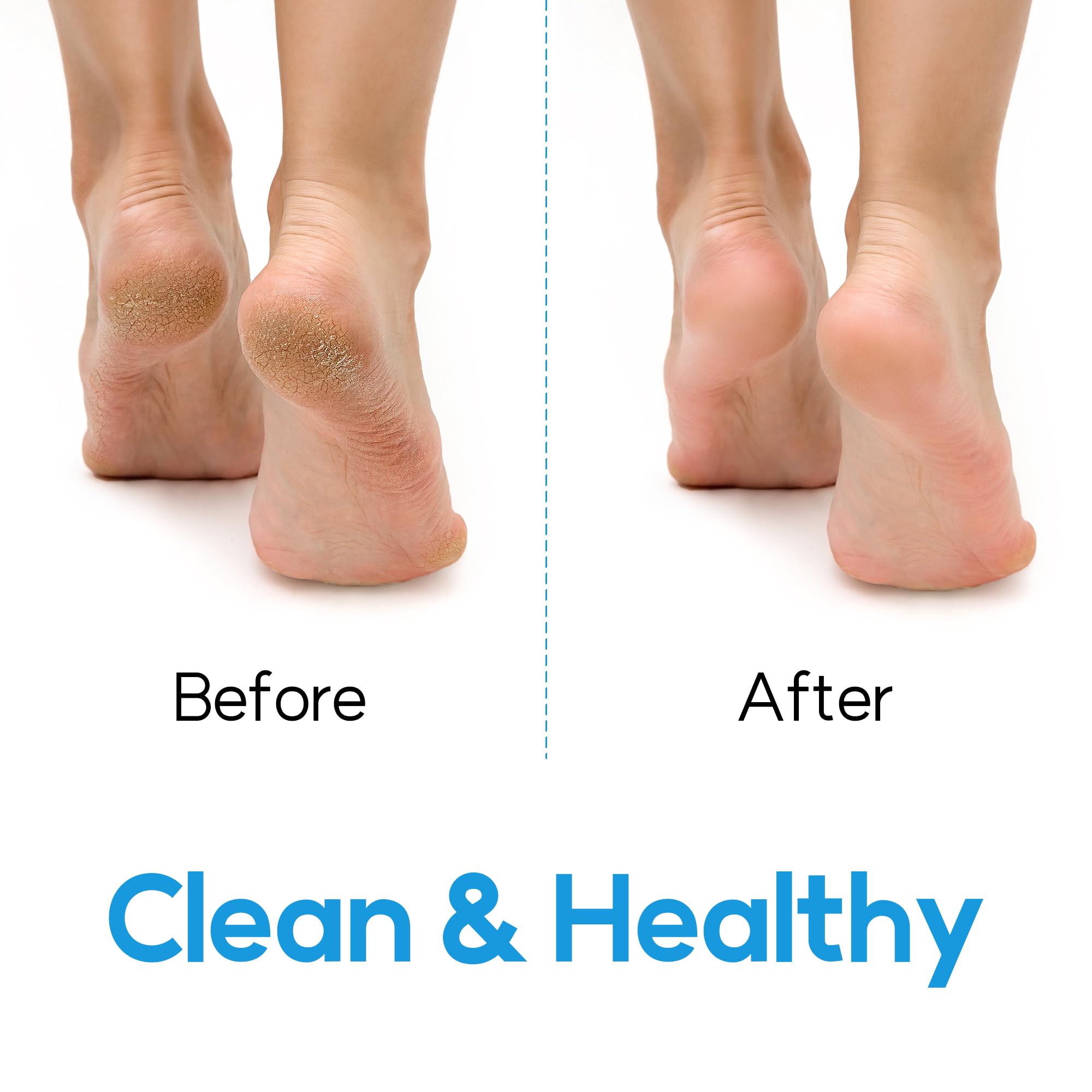 DalkomLife cepillo exfoliante mejora circulación en pies y piernas.