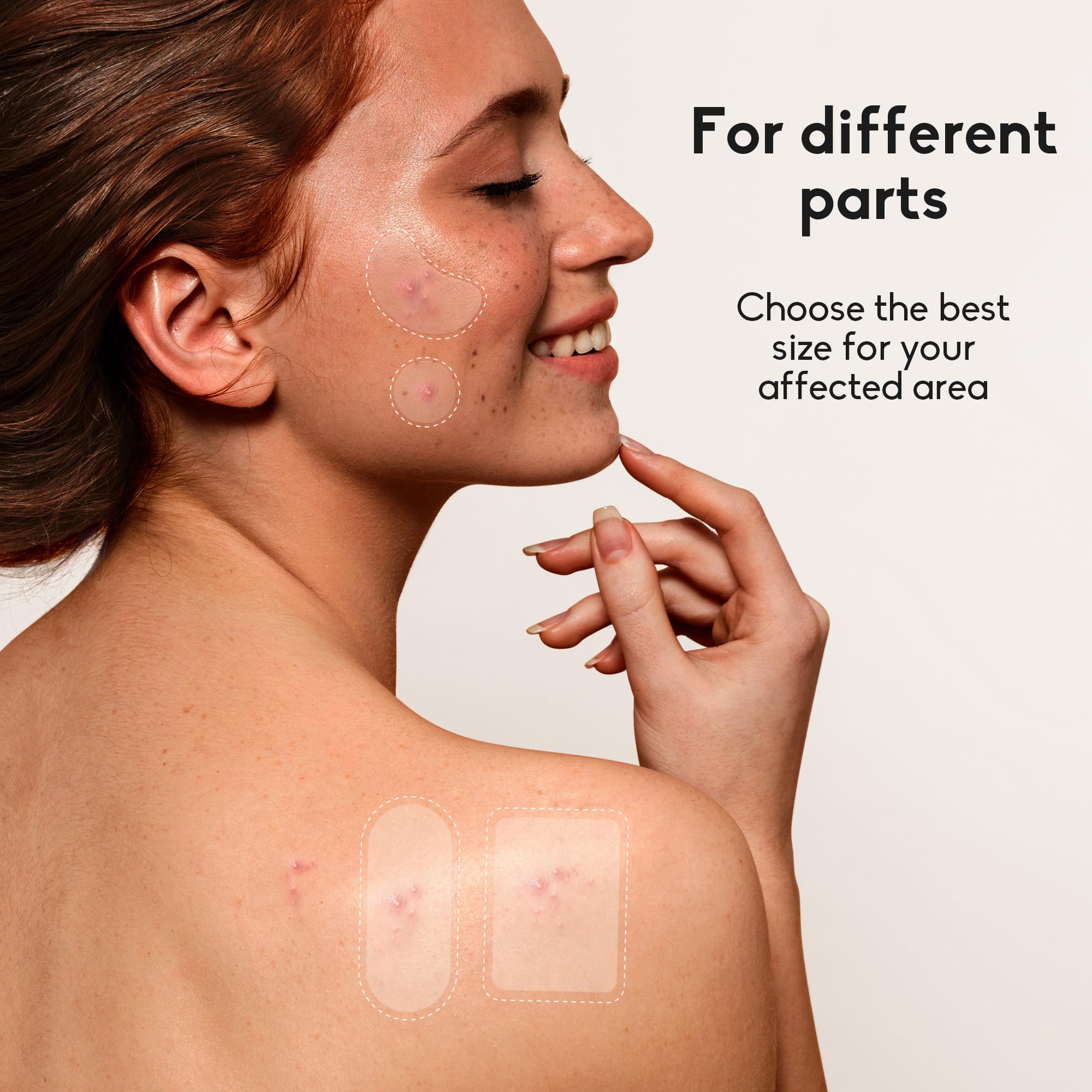 Daolyo round 12mm patch provides discreet protection for small outbreaks.
