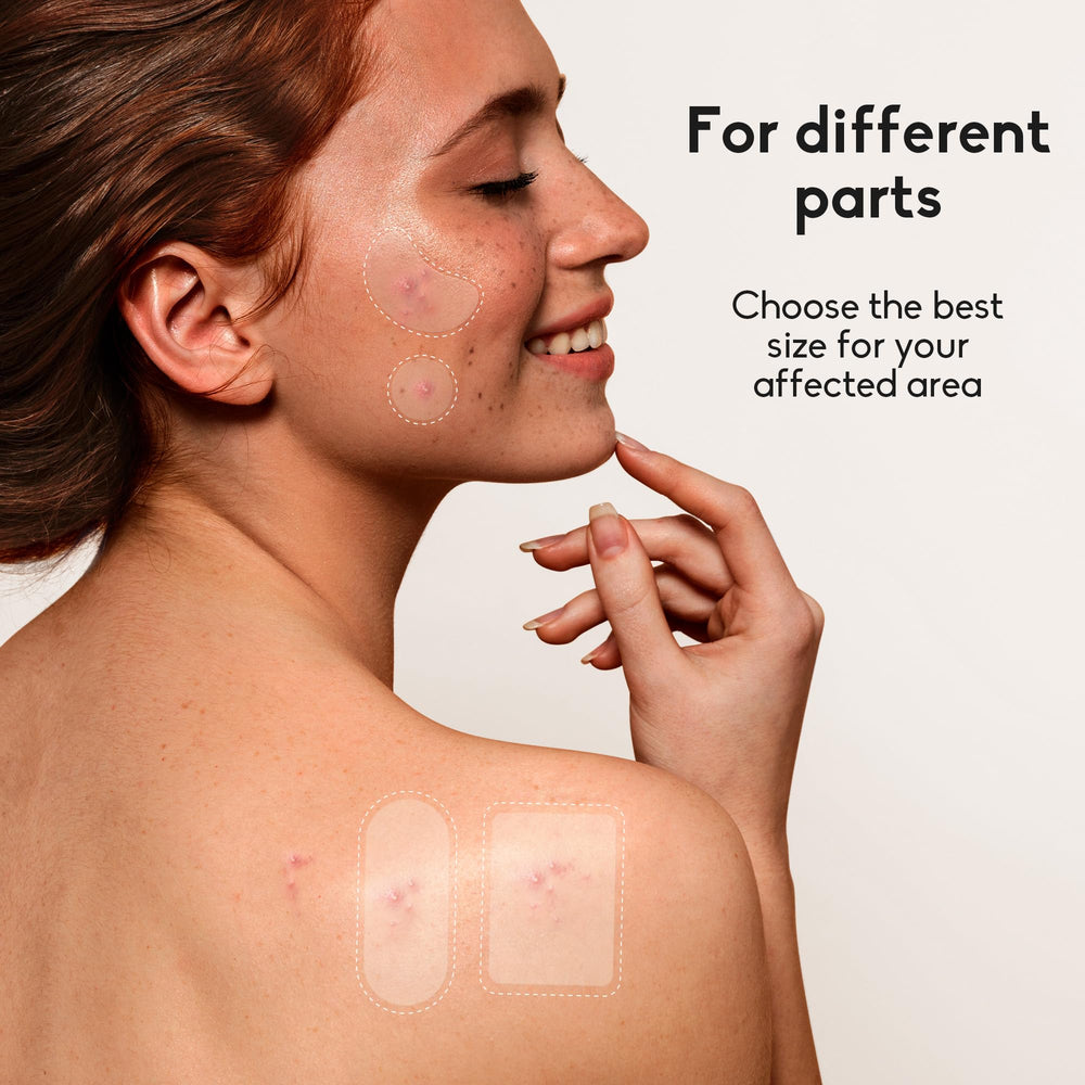 Daolyo round 12mm patch provides discreet protection for small outbreaks.