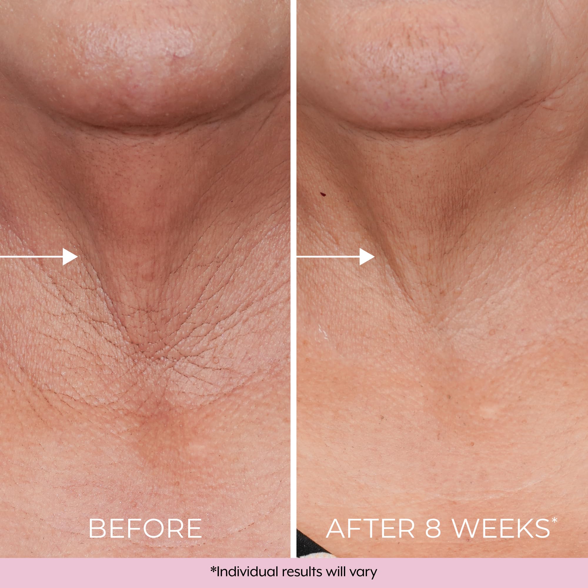 DEKLIDERM dermatologist-tested label indicates safety for most skin types.