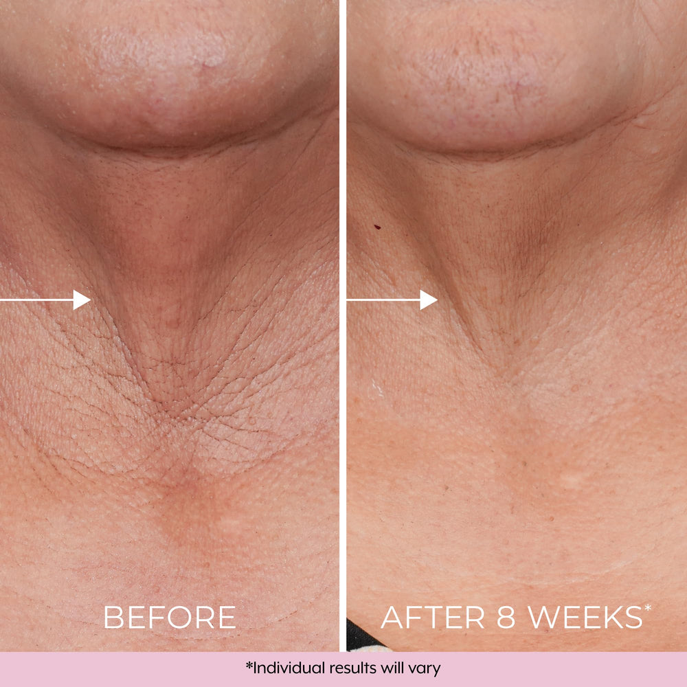 DEKLIDERM dermatologist-tested label indicates safety for most skin types.