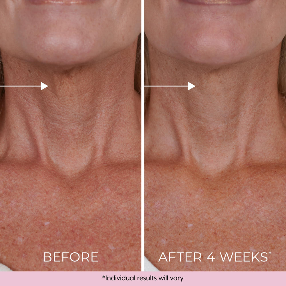 DEKLIDERM Retinol and Bakuchiol blend supports collagen and elastin.