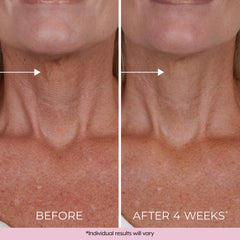DEKLIDERM Retinol and Bakuchiol blend supports collagen and elastin.