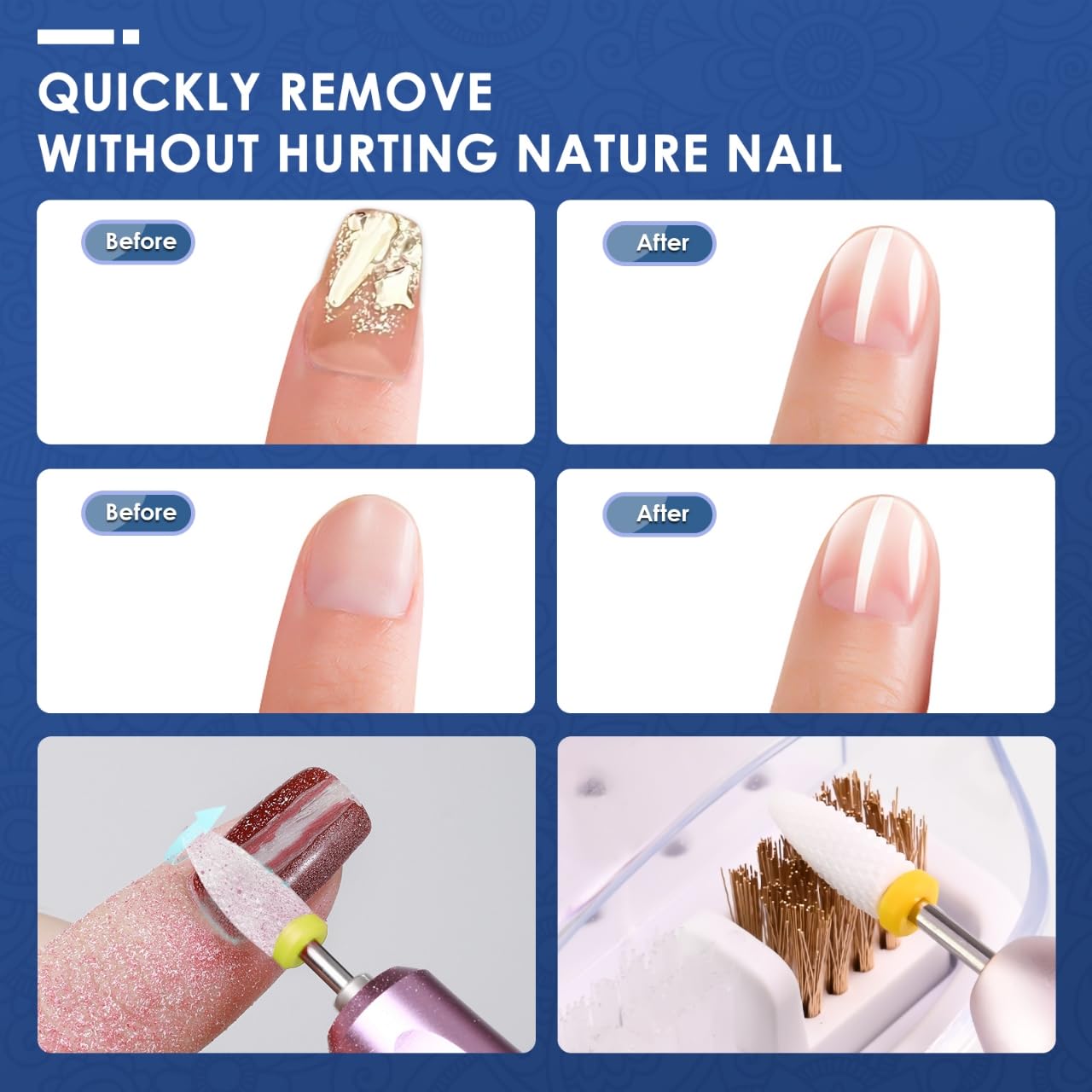 Depvko silicone bits and brushes for cleaning and maintenance after filing