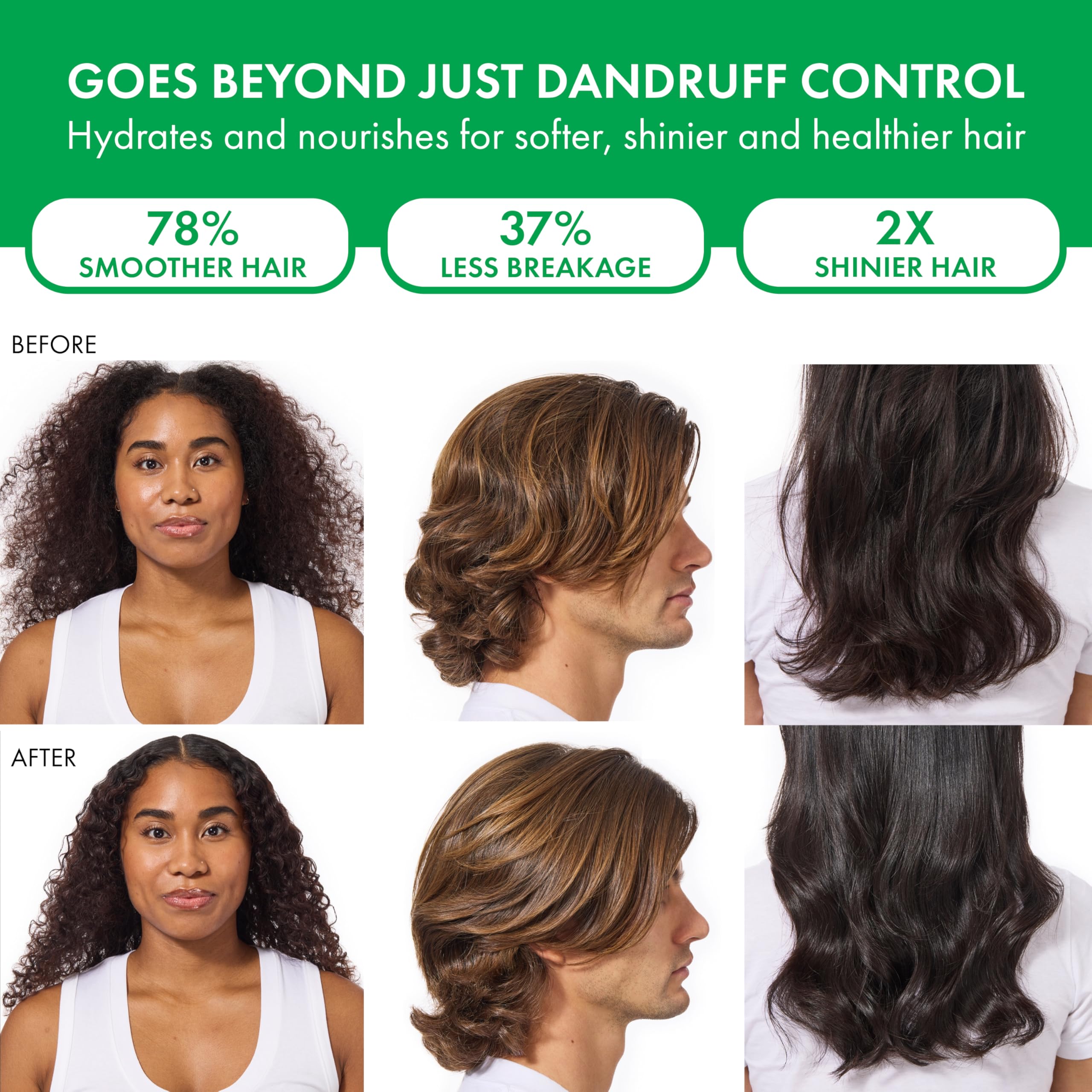 Dercos champú anticaspa: cabello seco con brillo mejorado y apariencia más saludable.