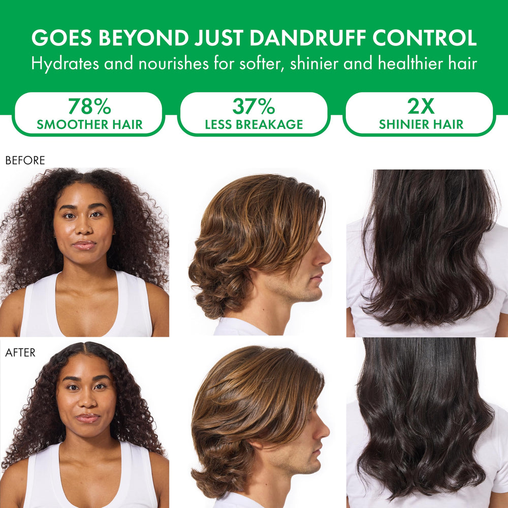 Dercos champú anticaspa: cabello seco con brillo mejorado y apariencia más saludable.