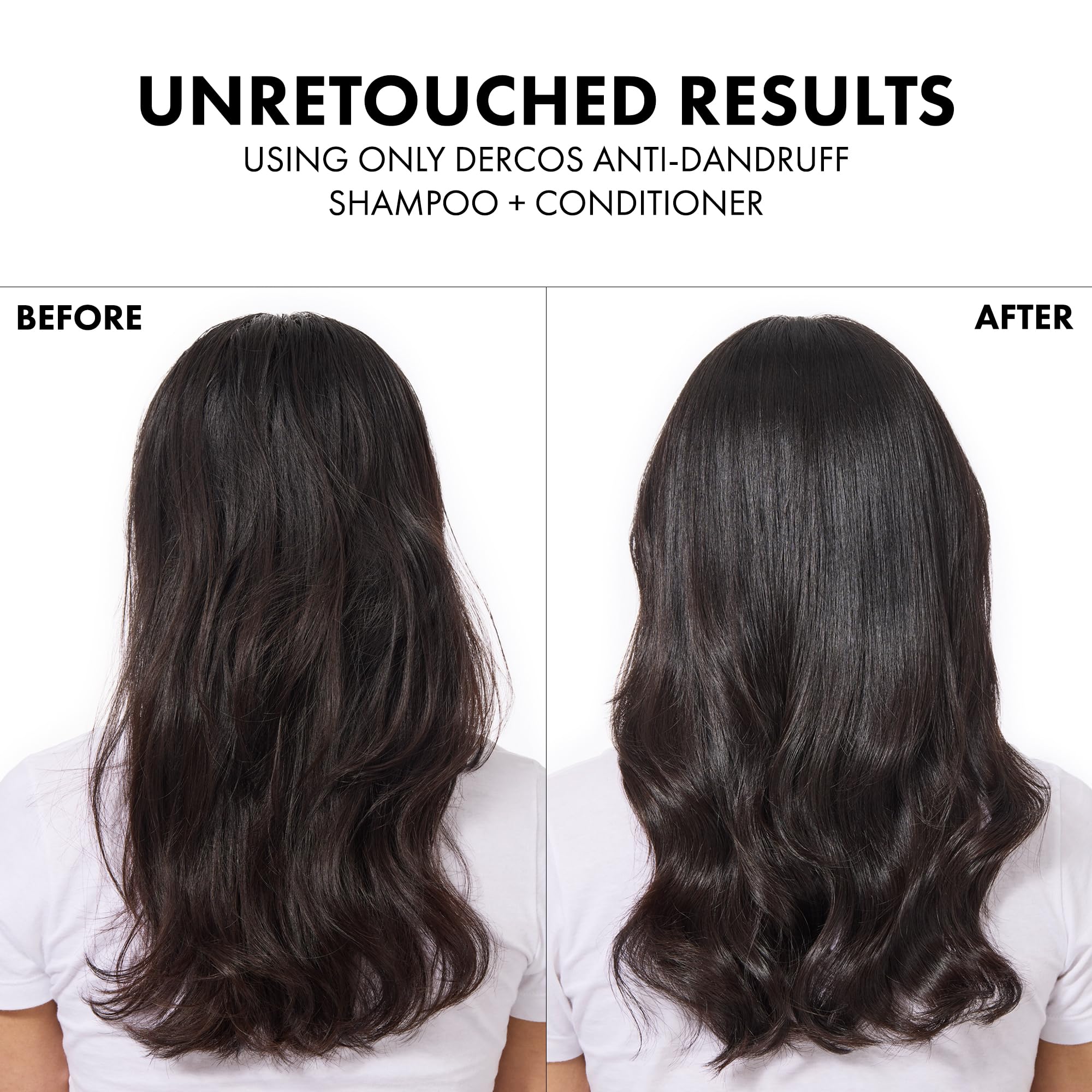Dercos-conditioned hair displays smoother texture and reduced frizz.