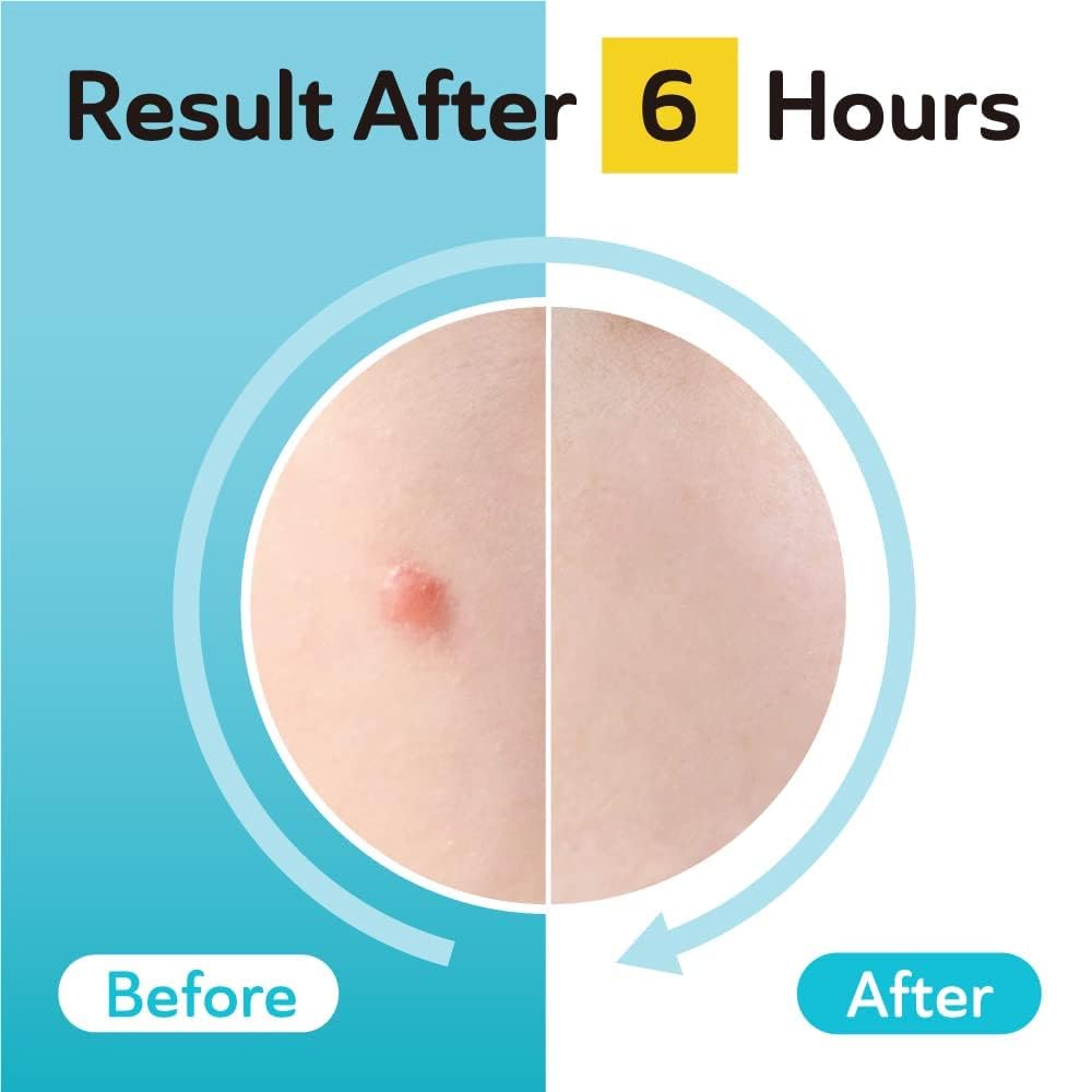 Thin matte finish patch applied for seamless skin blend