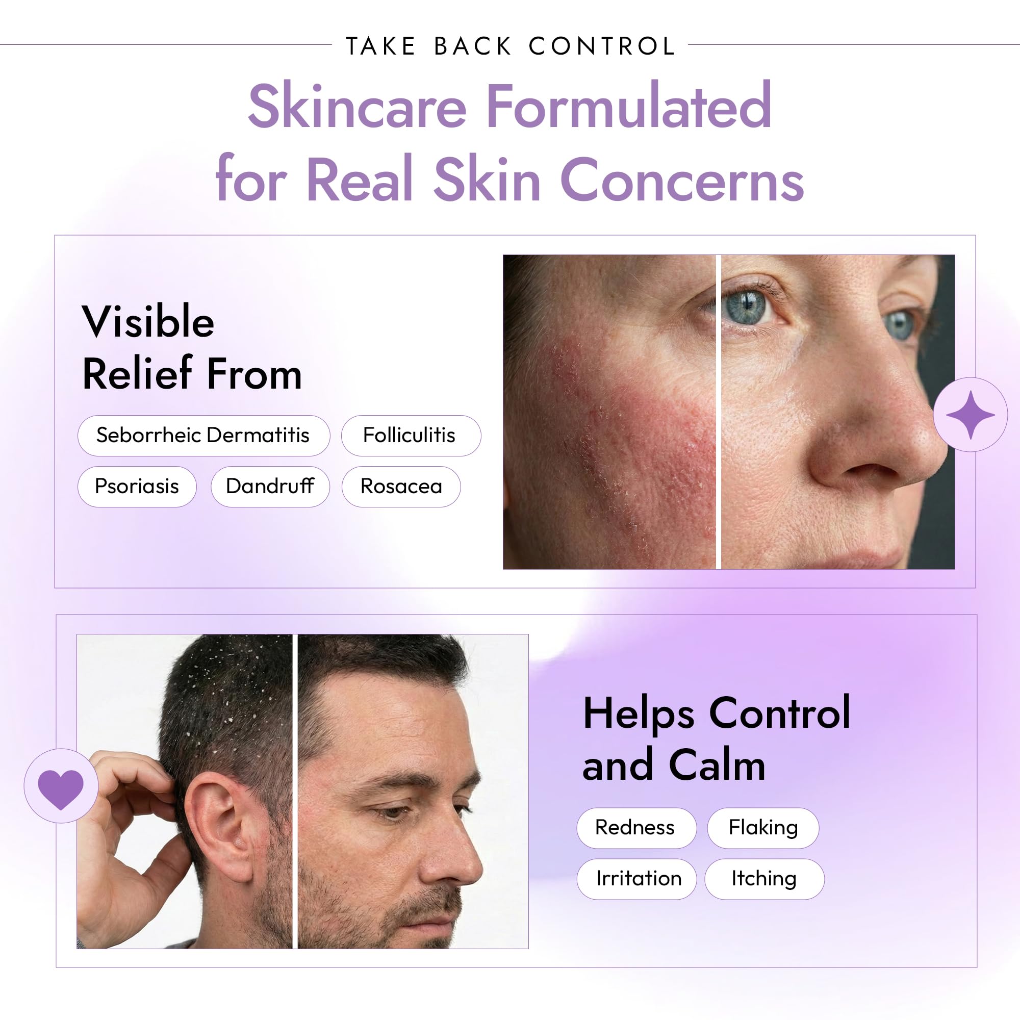 DERMAdoctor sensitive skin bottle showing USA-made packaging