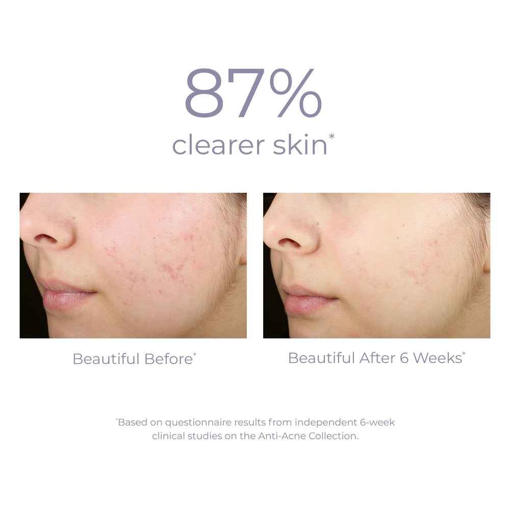 DERMA E Acne Spot Treatment: textura-serum suave que penetra