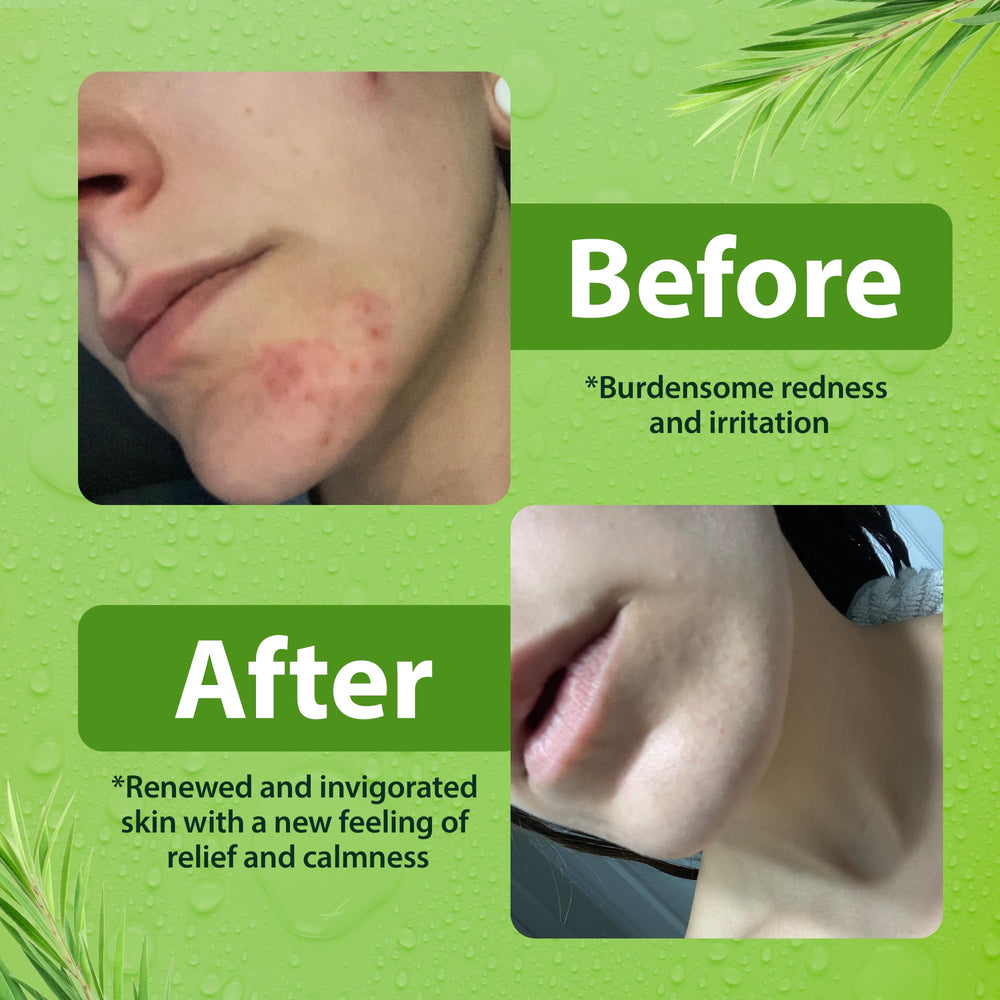 Derma-Nu body wash pump dispense for easy, controlled application.