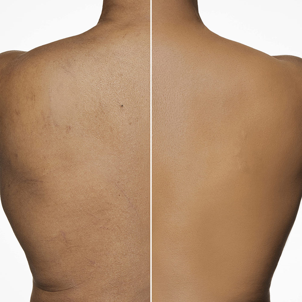 Dermablend shade 20N Light Natural swatch under SPF 25.