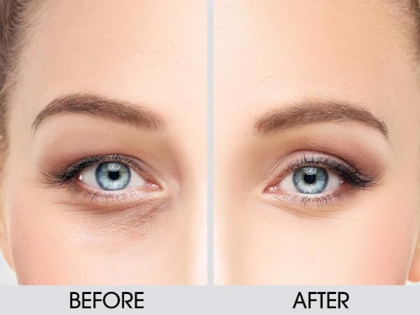 Firmeza suave alrededor de los ojos con Dermactin Clásico.