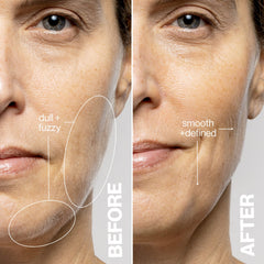 DERMAFLASH LUXE+ safety cage close-up protecting skin during dermaplaning