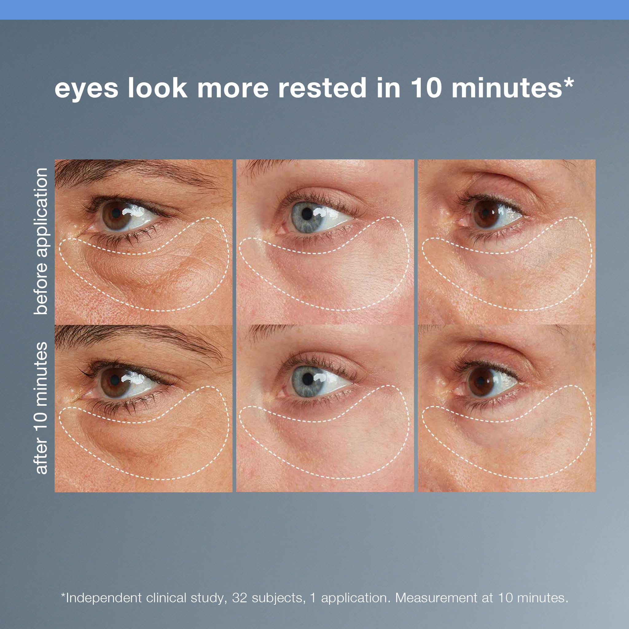 Dermalogica Awaken Peptide Eye Gel is applied under the eye for smoother texture.