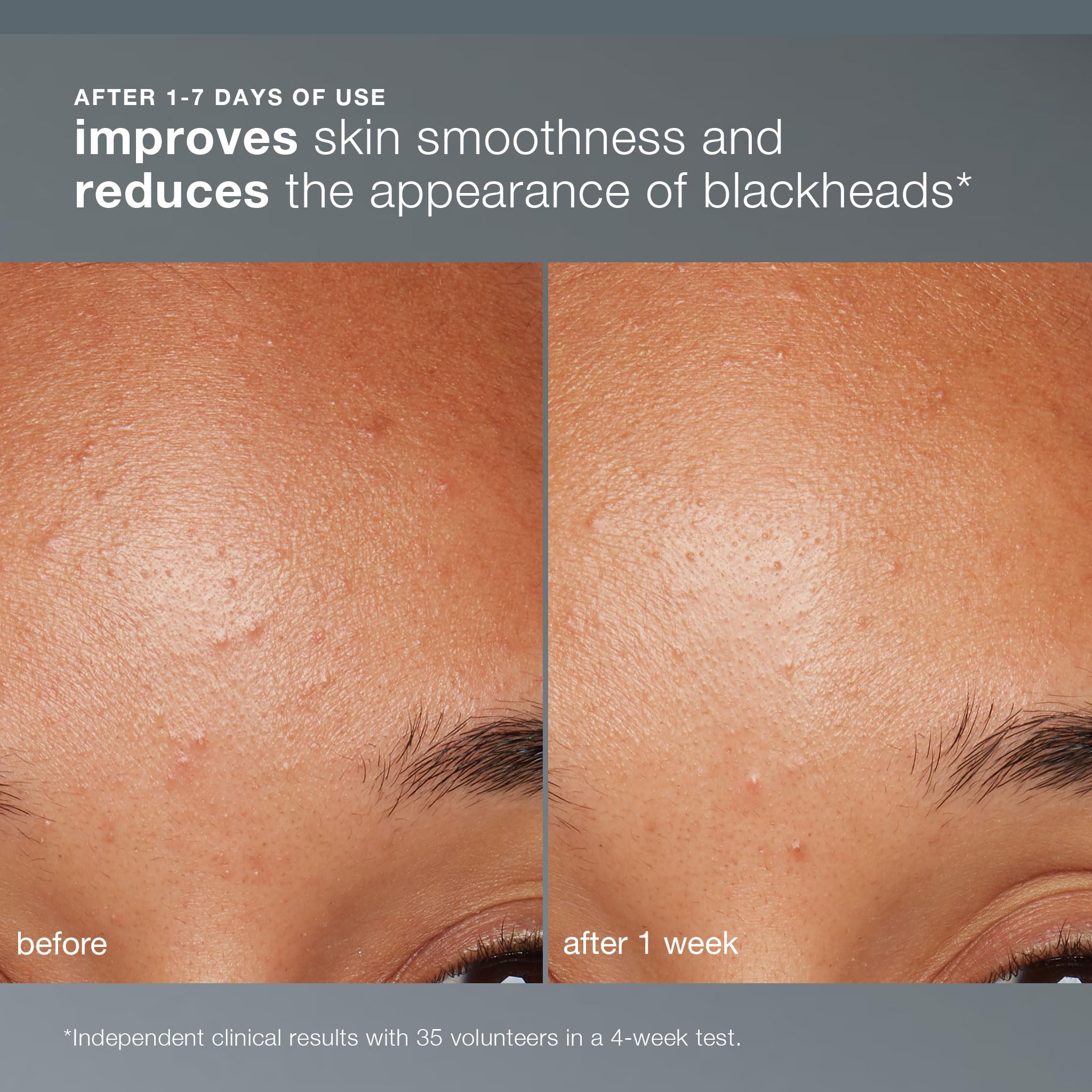Papaya enzyme and salicylic beads in Dermalogica Daily Microfoliant.