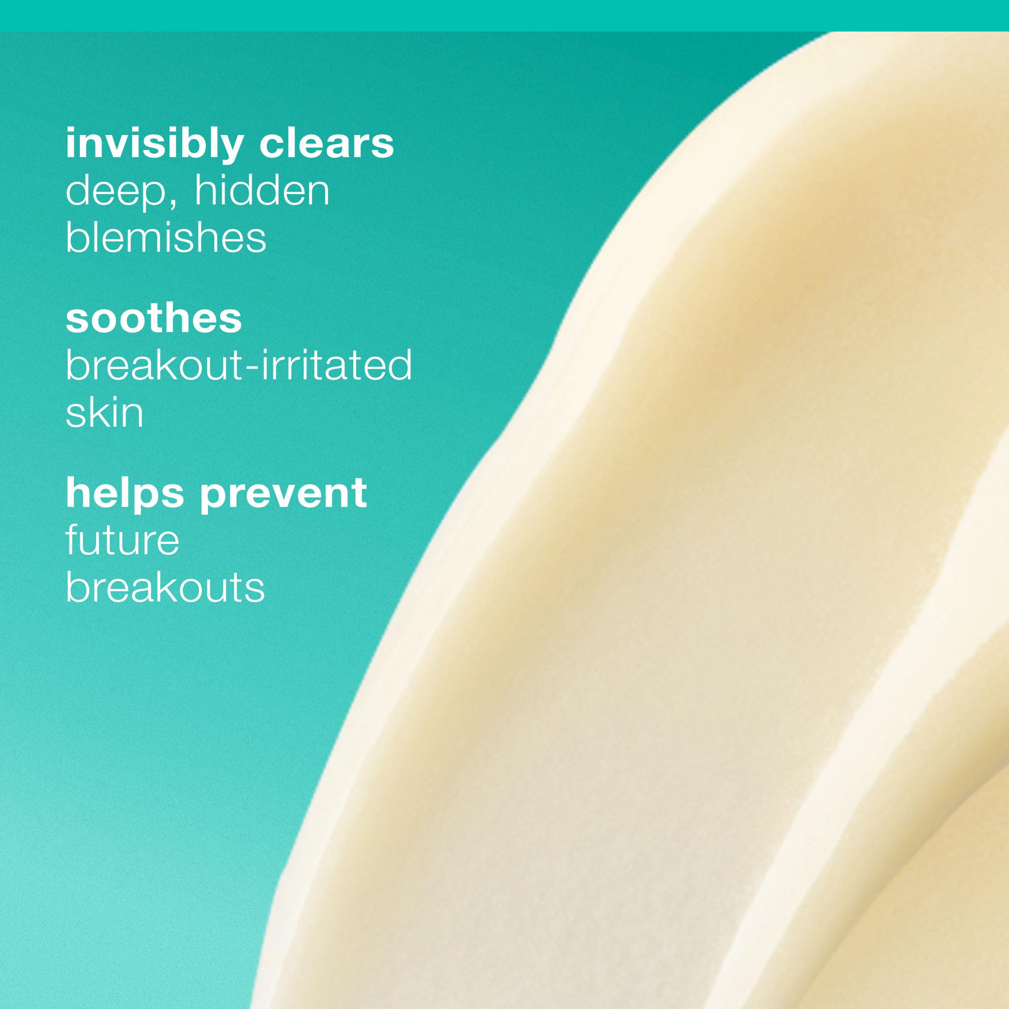 Dermalogica Deep Acne Liquid Patch Niacinamide benefiting skin balance during treatment.
