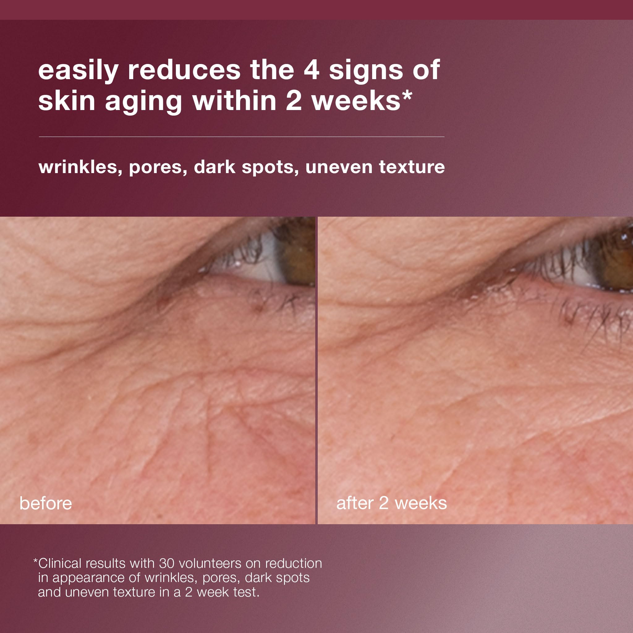Dermalogica Dynamic Skin Retinol Serum dropper-ready, ideal for nightly application.