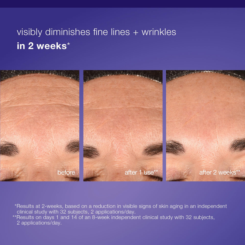Exosome technology visualization for gentle resurfacing with Phyto Nature E2