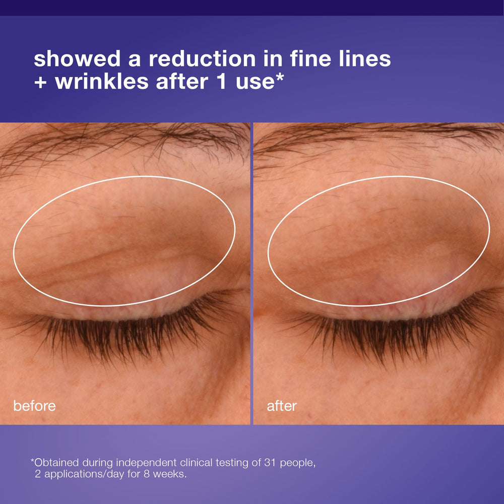 Dermalogica Phyto Nature Lifting Eye Cream soft texture for easy absorption.