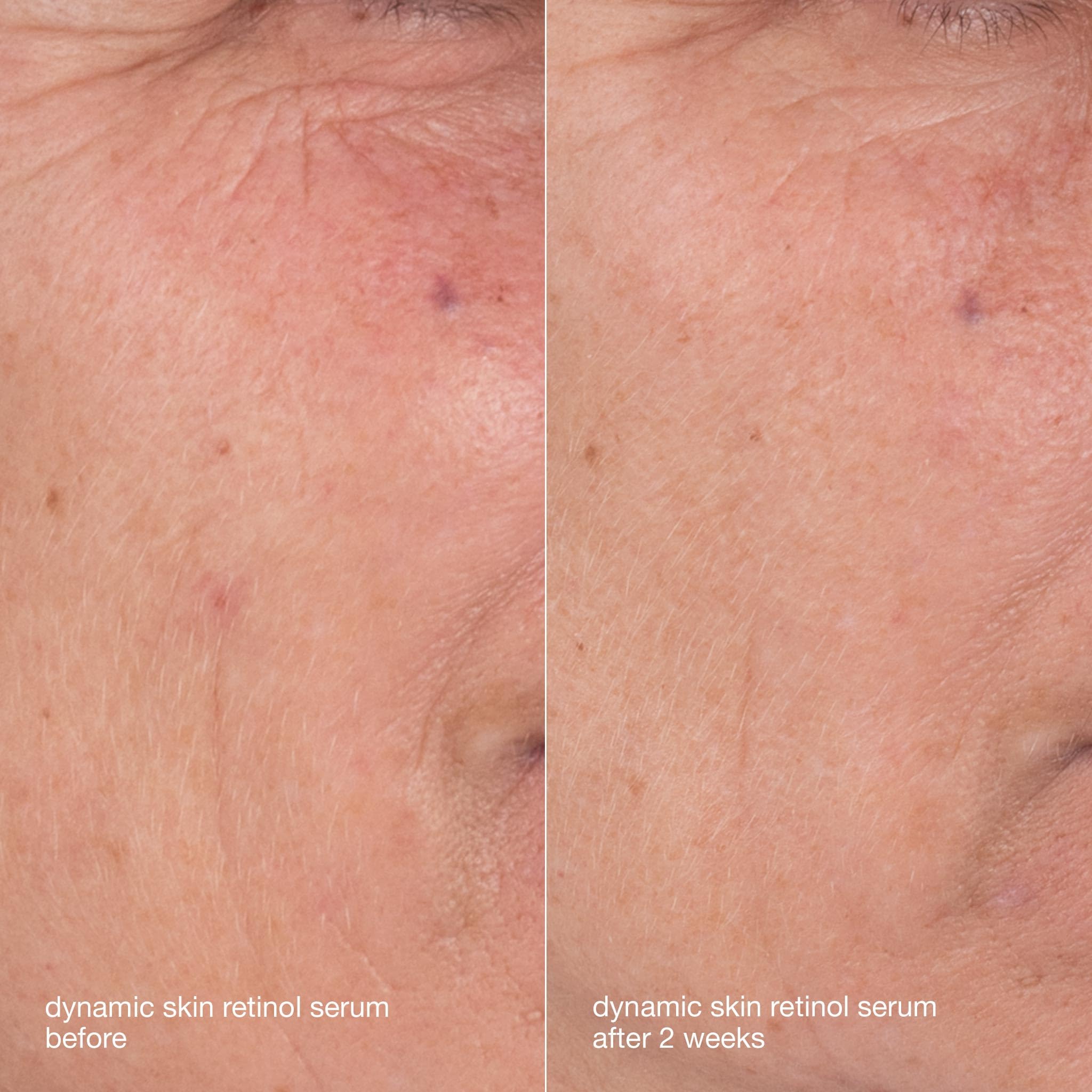 Dermalogica Skin Aging Solutions Kit routine layout showing cleansing, serum, and cream steps.