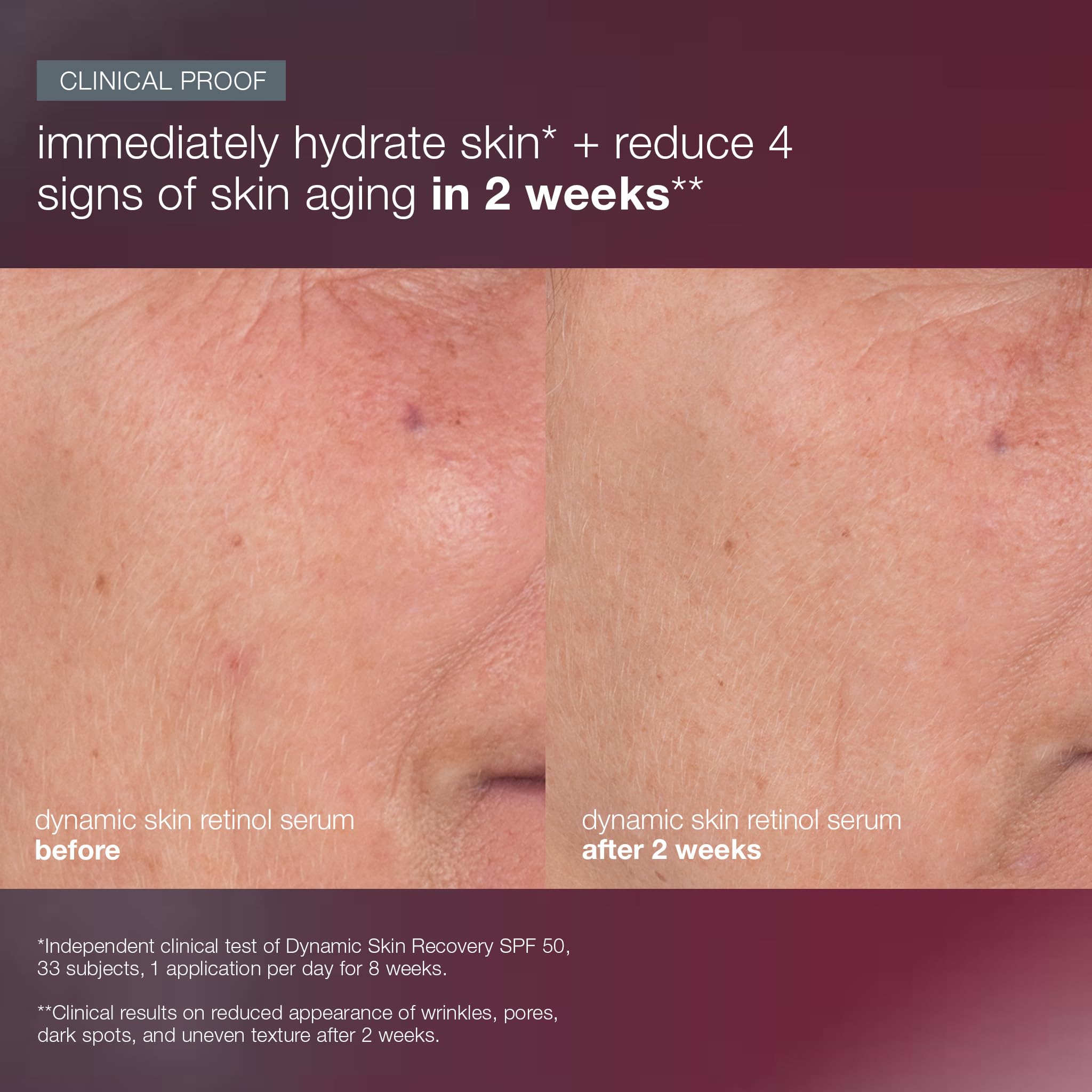 Dermalogica Skin Aging Solutions Kit skin texture close-up after use.