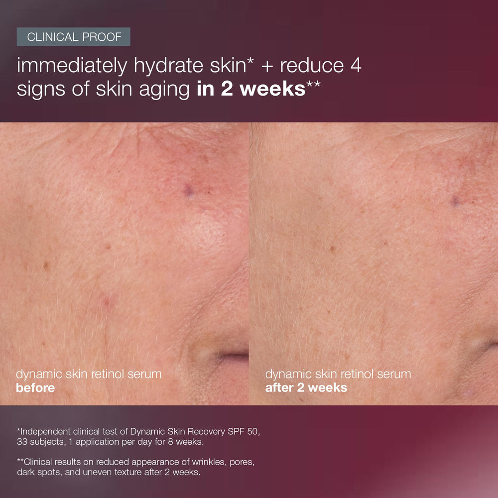 Dermalogica Skin Aging Solutions Kit skin texture close-up after use.