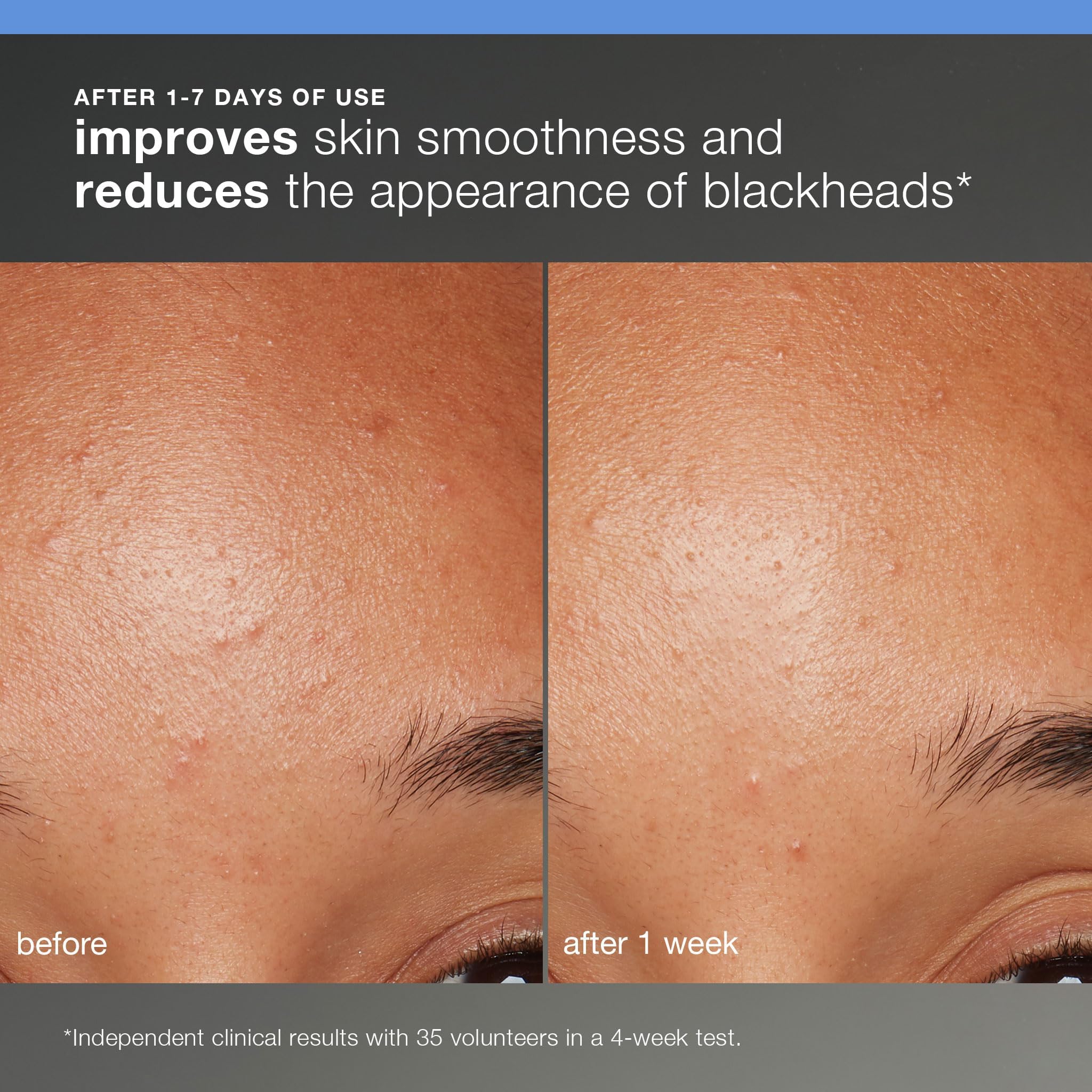 Dermalogica Skin Smoothing Cream tub marks hydrating moisturizer for soft, smooth skin.