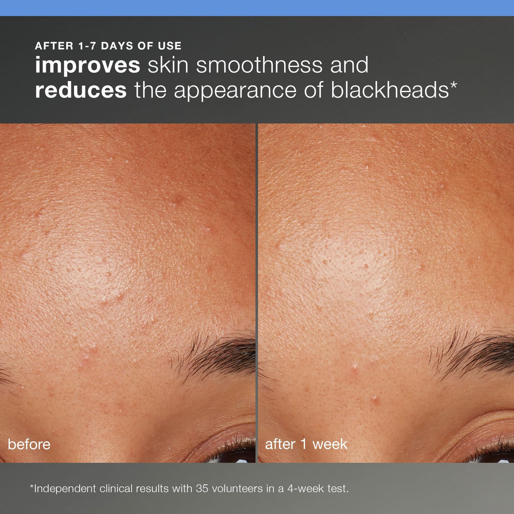 Dermalogica Skin Smoothing Cream tub marks hydrating moisturizer for soft, smooth skin.