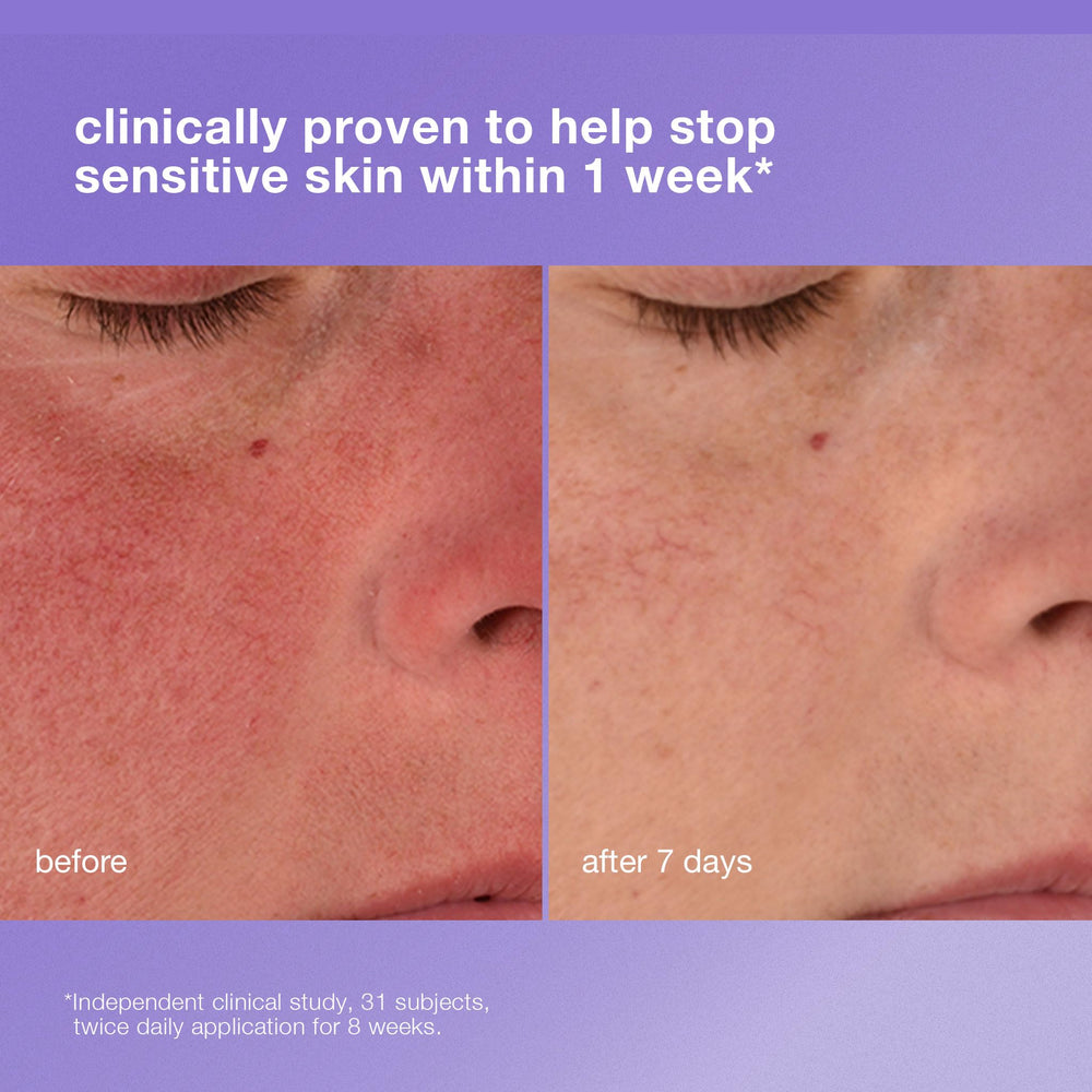 Close-up of face after application with comfort and reduced redness